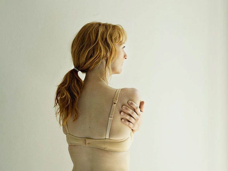 Treating Saggy Breasts