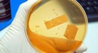 Salmonella Food Poisoning
