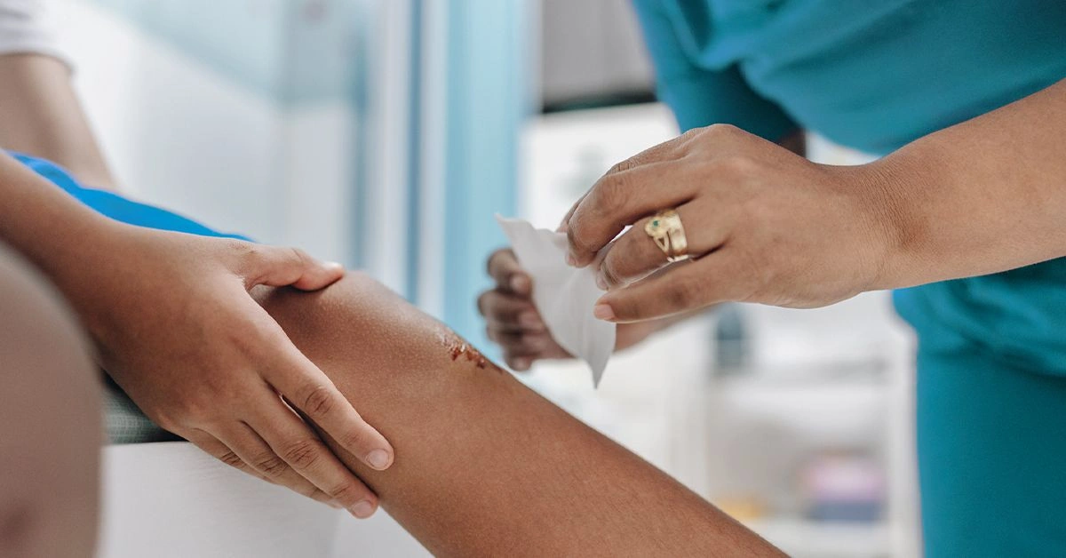 Is It Serosanguinous or Another Type of Wound Drainage?