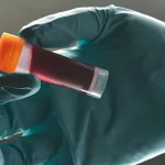 What Is Serum Cholesterol and Why Is It Important?