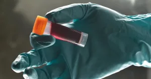 What Is Serum Cholesterol and Why Is It Important?