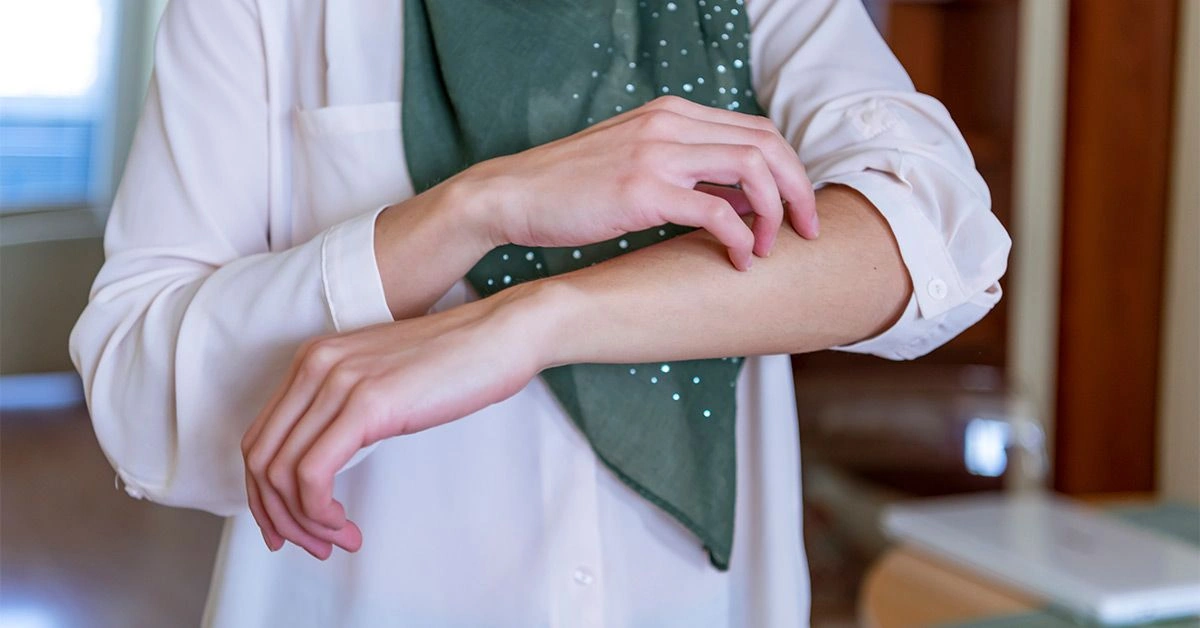 Shingles vs. Poison Ivy: How to Tell the Difference