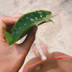 Why Aloe Vera for Sunburn May Be Just What You Need