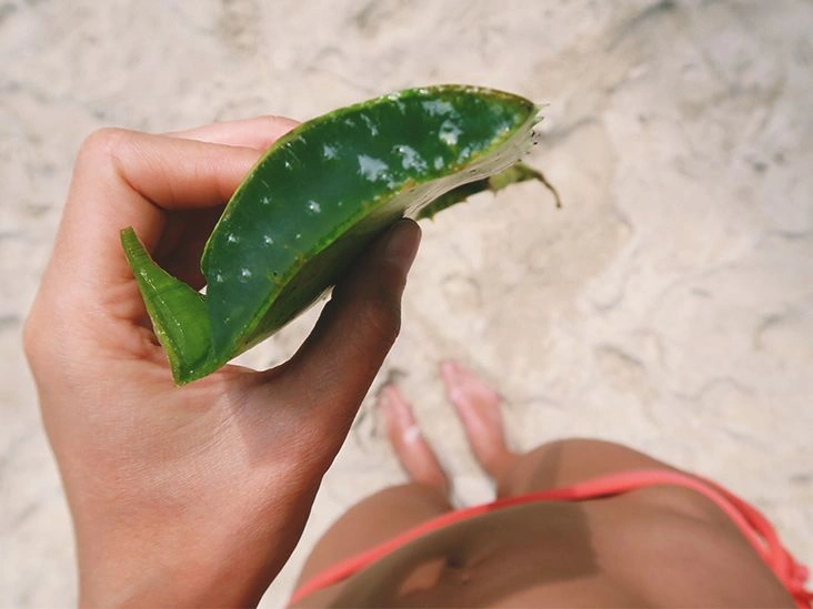 Why Aloe Vera for Sunburn May Be Just What You Need