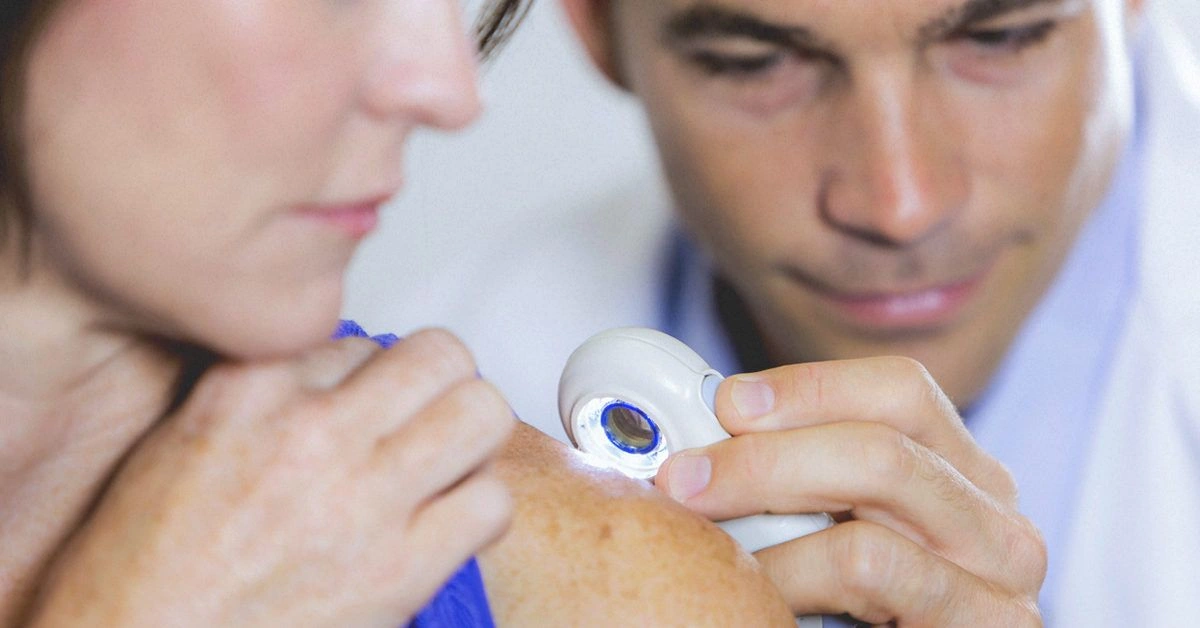 What Are Skin Neoplasms?
