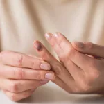 Treatment and Recovery for a Smashed Finger