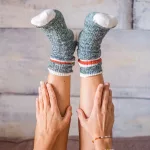 What Does It Mean If You Have Sock Marks on Your Legs?