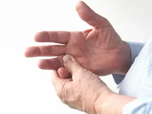 Sprained Finger