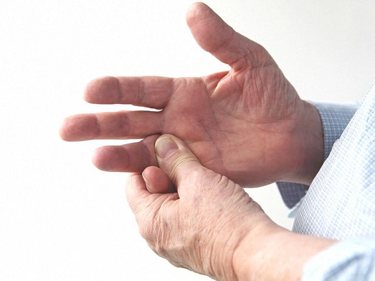 Sprained Finger