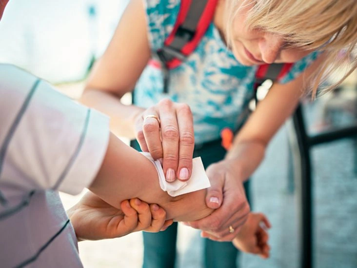 How to Care for Steri-Strips: A Step-by-Step Guide