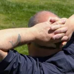 Sunburned scalp