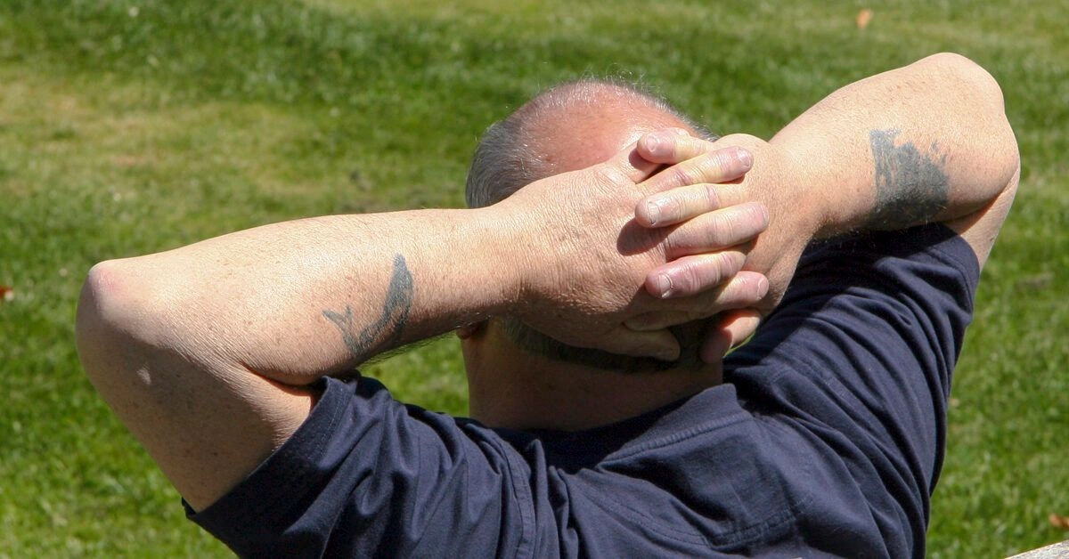Sunburned scalp