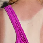 How to Identify a Tanning Bed Rash