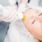 Thermage vs. Ultherapy