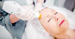 Thermage Vs Ultherapy: Choosing the Better Option