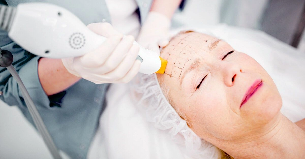 Thermage vs. Ultherapy