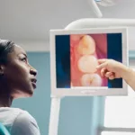 Debunking the Myth of Tooth Worms and Other Cavity Causes