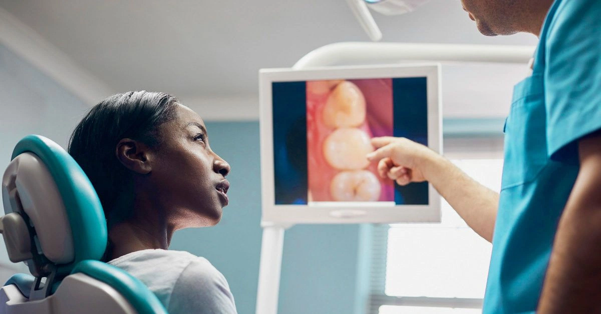Debunking the Myth of Tooth Worms and Other Cavity Causes