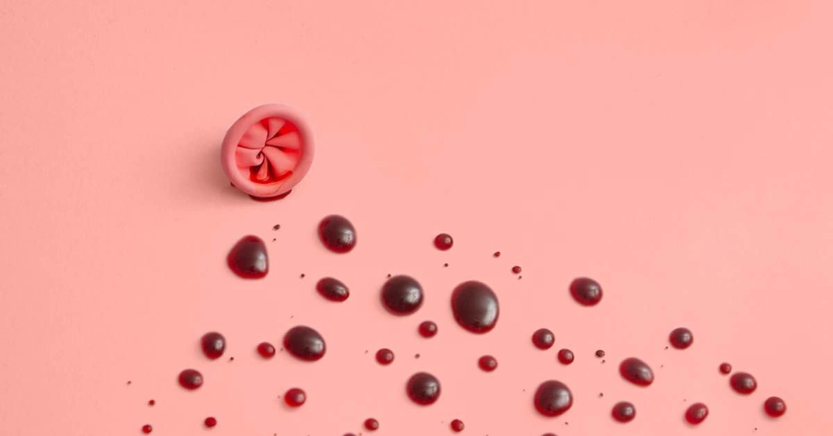 What the Different Types of Hemorrhoids Look Like