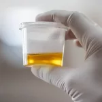 Urine Test Alcohol Detection & Timing