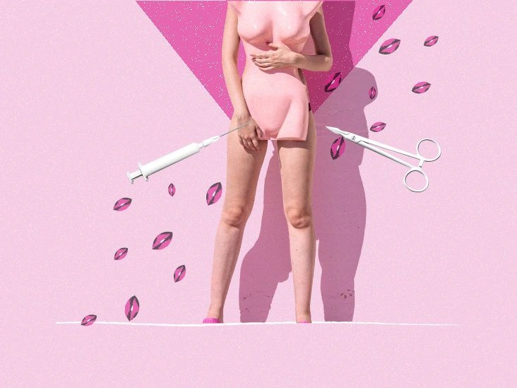 The Quest for the Perfect V: Why Are More Women Seeking Vaginal Rejuvenation?