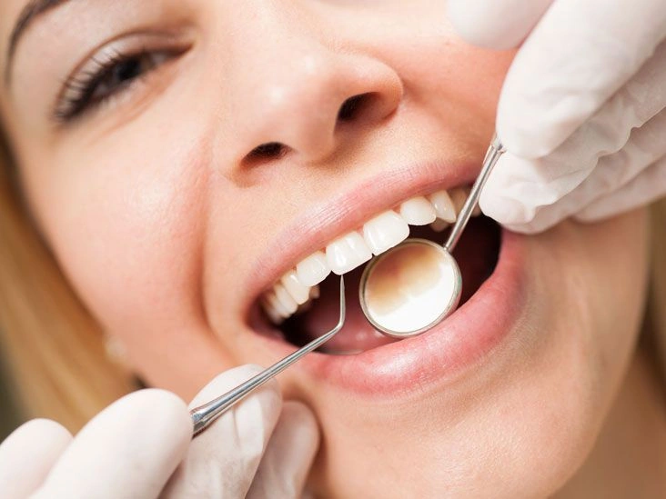 What Happens During Your Professional Dental Cleaning