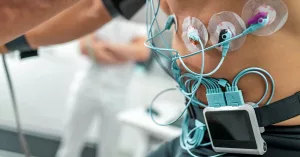 What Does It Mean If Your Stress Test Results Are “Abnormal?”