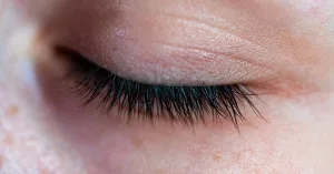 What Causes Eyelash Pain? What Causes Eyelash Pain?