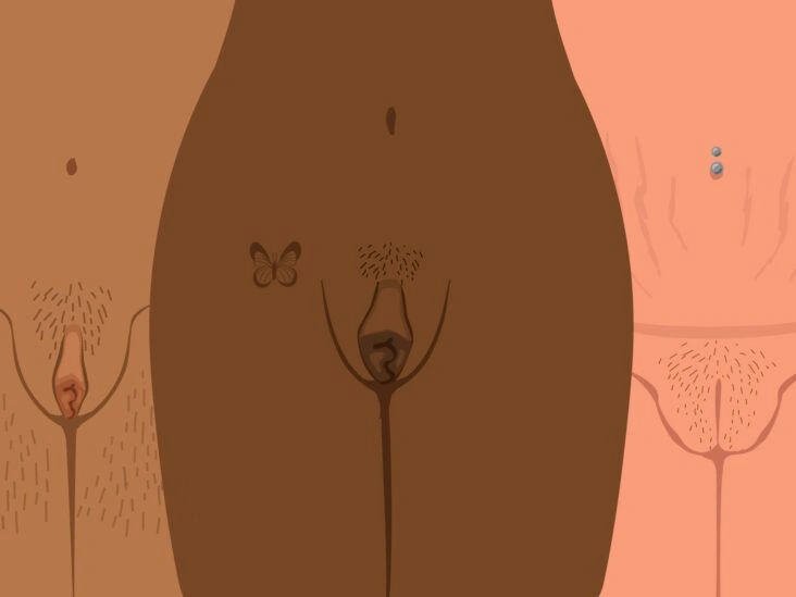 What Do ‘Normal’ Labia Look Like?