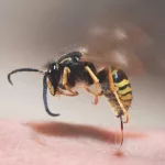 What to Do for Yellow Jacket Stings