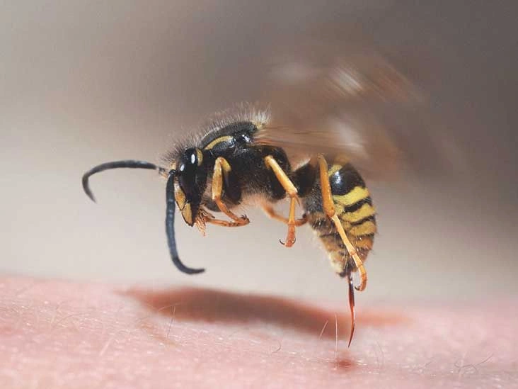 What to Do for Yellow Jacket Stings