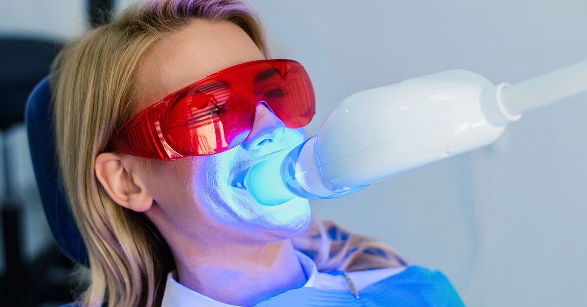 What to Know About Zoom Teeth Whitening