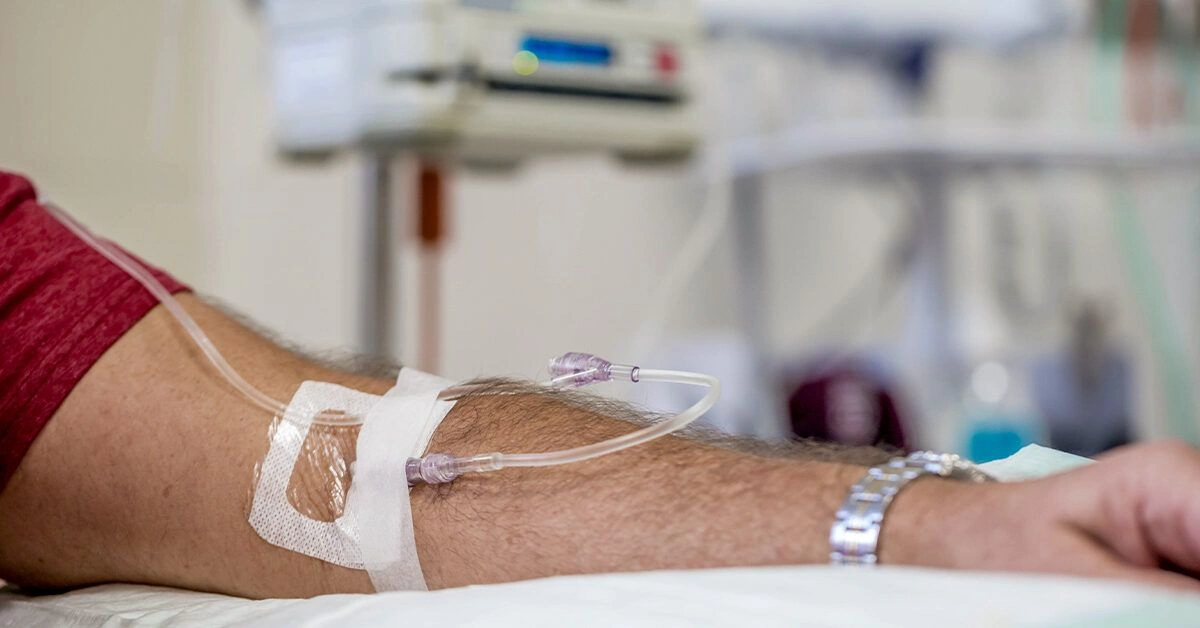 CAR T-Cell Therapy for Multiple Myeloma