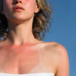 7 Body Parts People Always Miss with Sunscreen