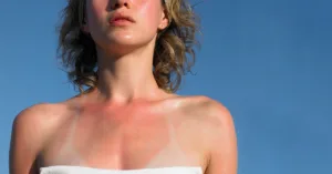 7 Body Parts People Always Miss with Sunscreen 7 Body Parts People Always Miss with Sunscreen