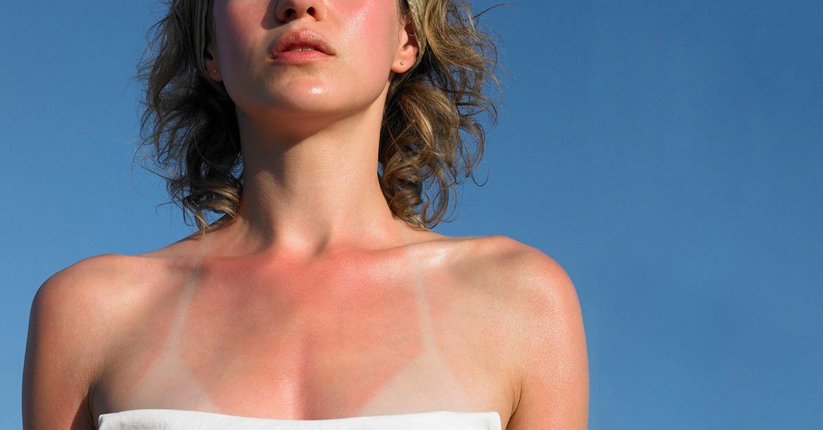 7 Body Parts People Always Miss with Sunscreen