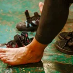 Everything You Need to Know About Fungal Skin Infections