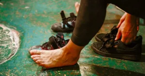 Everything You Need to Know About Fungal Skin Infections