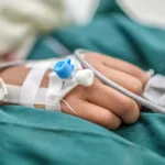 Can I Be Allergic to Anesthesia?