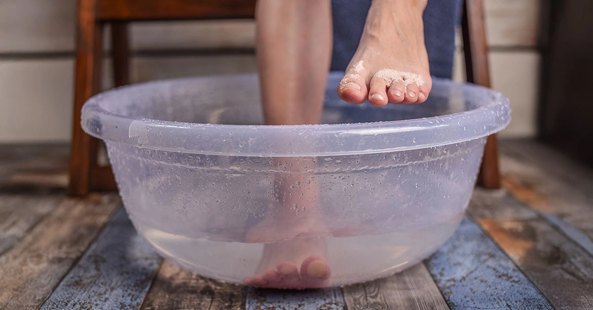 Home Remedies for Athlete’s Foot, Plus How to Stop It from Coming Back