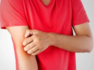 What To Know About Skin Infections What To Know About Skin Infections