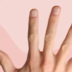 What These 8 Fingernail Signs Say About Your Health