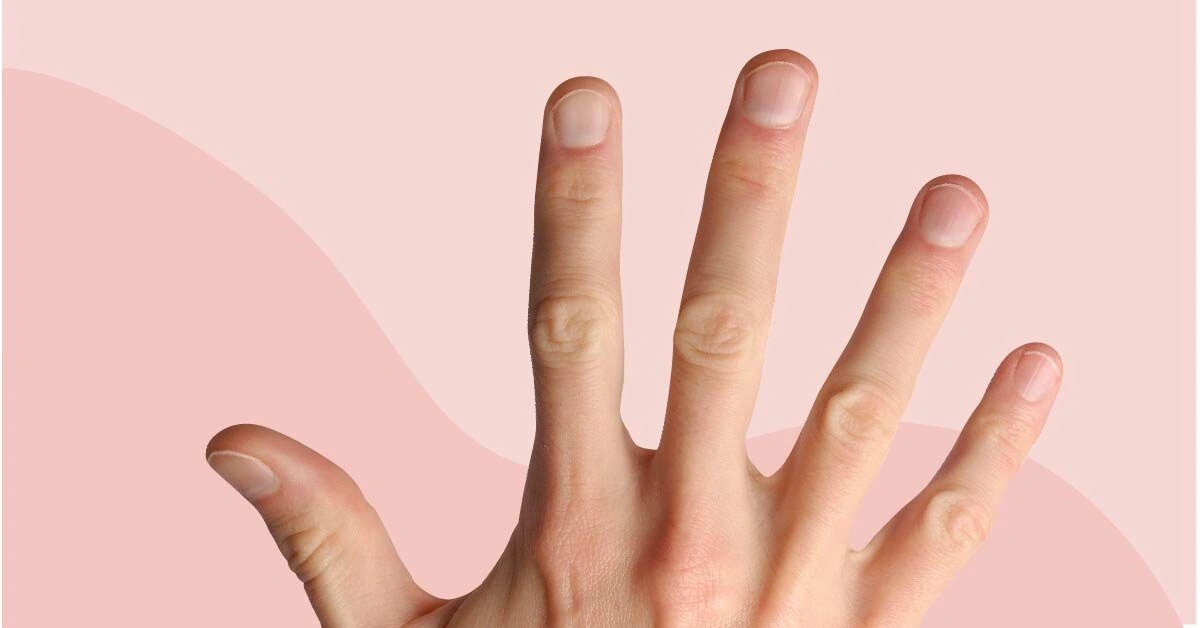 What These 8 Fingernail Signs Say About Your Health