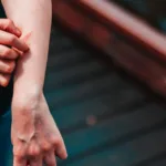 How Long Do the Symptoms of Eczema Last?