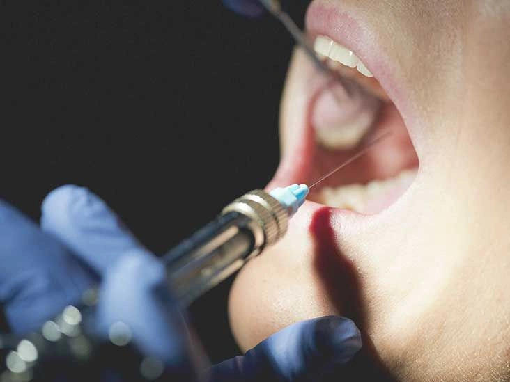 How Long Does Novocaine Last?