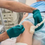 Radiofrequency Ablation: An Overview