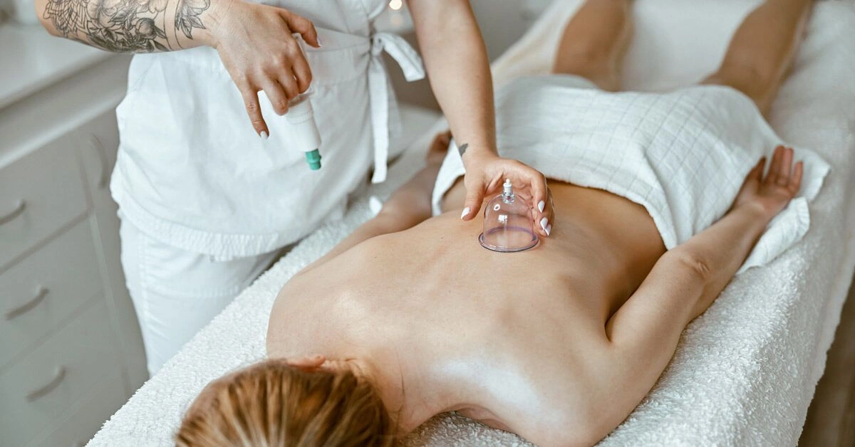 Does Cupping Therapy Work for Low Back Pain?