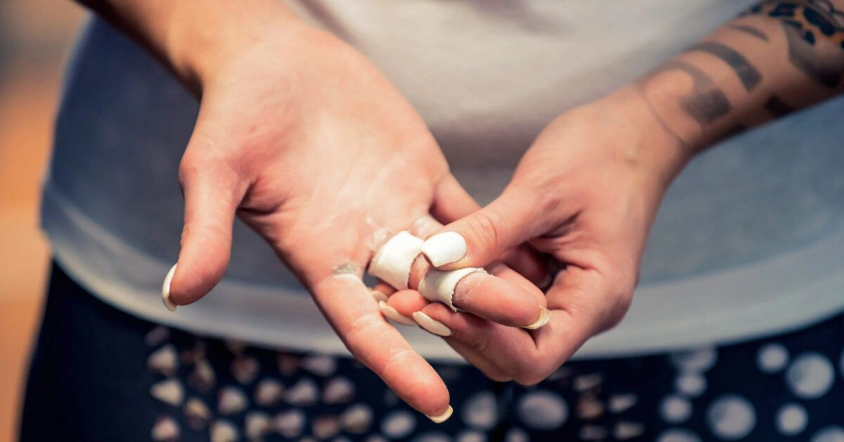 How to Get Rid of a Blister