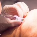 Will Medicare Cover Rooster Comb Injections?