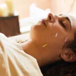 Does Getting Acupuncture Hurt?